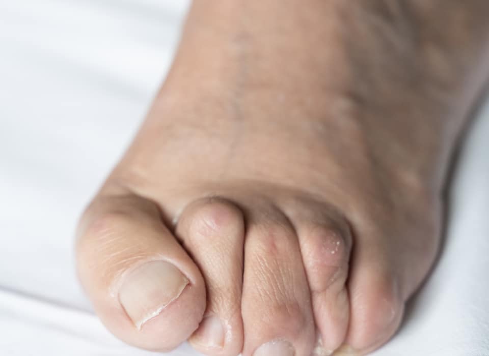 Foot specialist Perth | Dr Gerard Hardisty | The Foot & Ankle Centre
